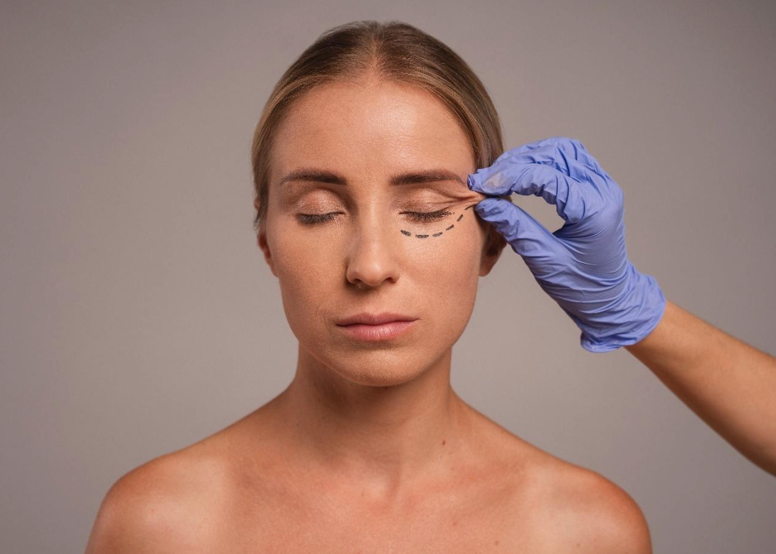 Deep Plane Facelift: Is It Still Relevant When the Optimum Mobility Facelift Is More Advanced?